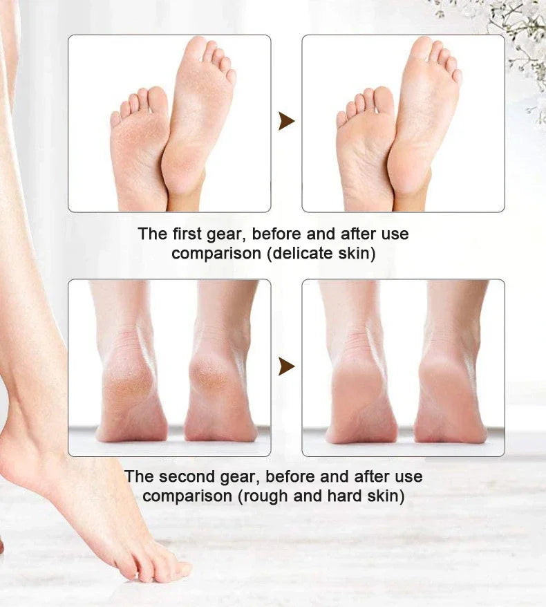 Rechargeable  Electric Callus Remover for Feet 、Portable Foot Callus Remover Waterproof Profess Pedicure Foot File Pedicure Tool